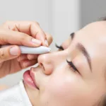 Close-up of a hand using a no-slip skincare tool to extract a blackhead